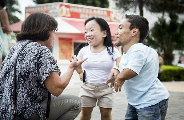 矮小是因为生来患有一种罕见的疾病--发育不良性侏儒症(diastrophic